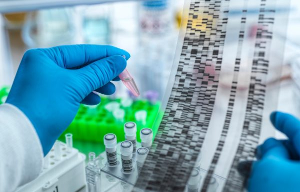 Scientist analyzing DNA gel electrophoresis results in a laboratory